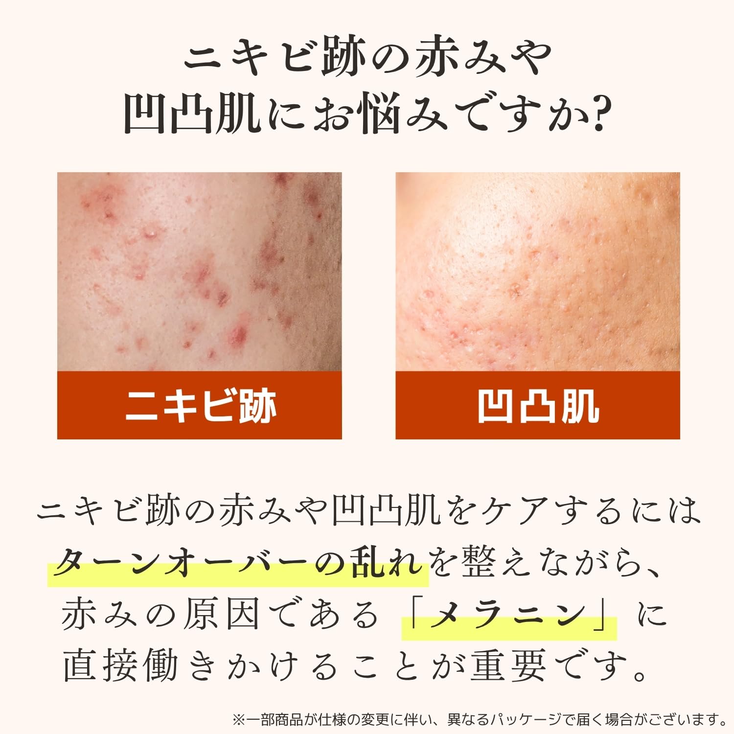 Amazon.co.jp: ドクターRe9 [薬用] ニキビ跡 専用 スキンケア4点セット